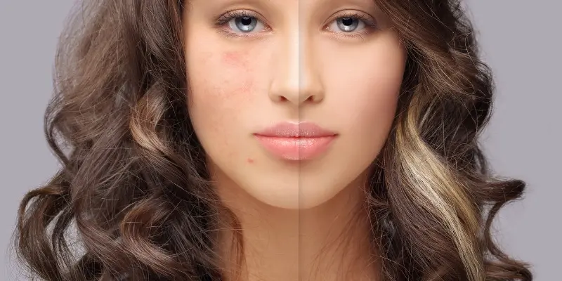 Treats Dark Spots